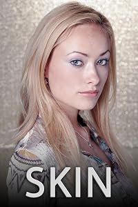 Skin poster